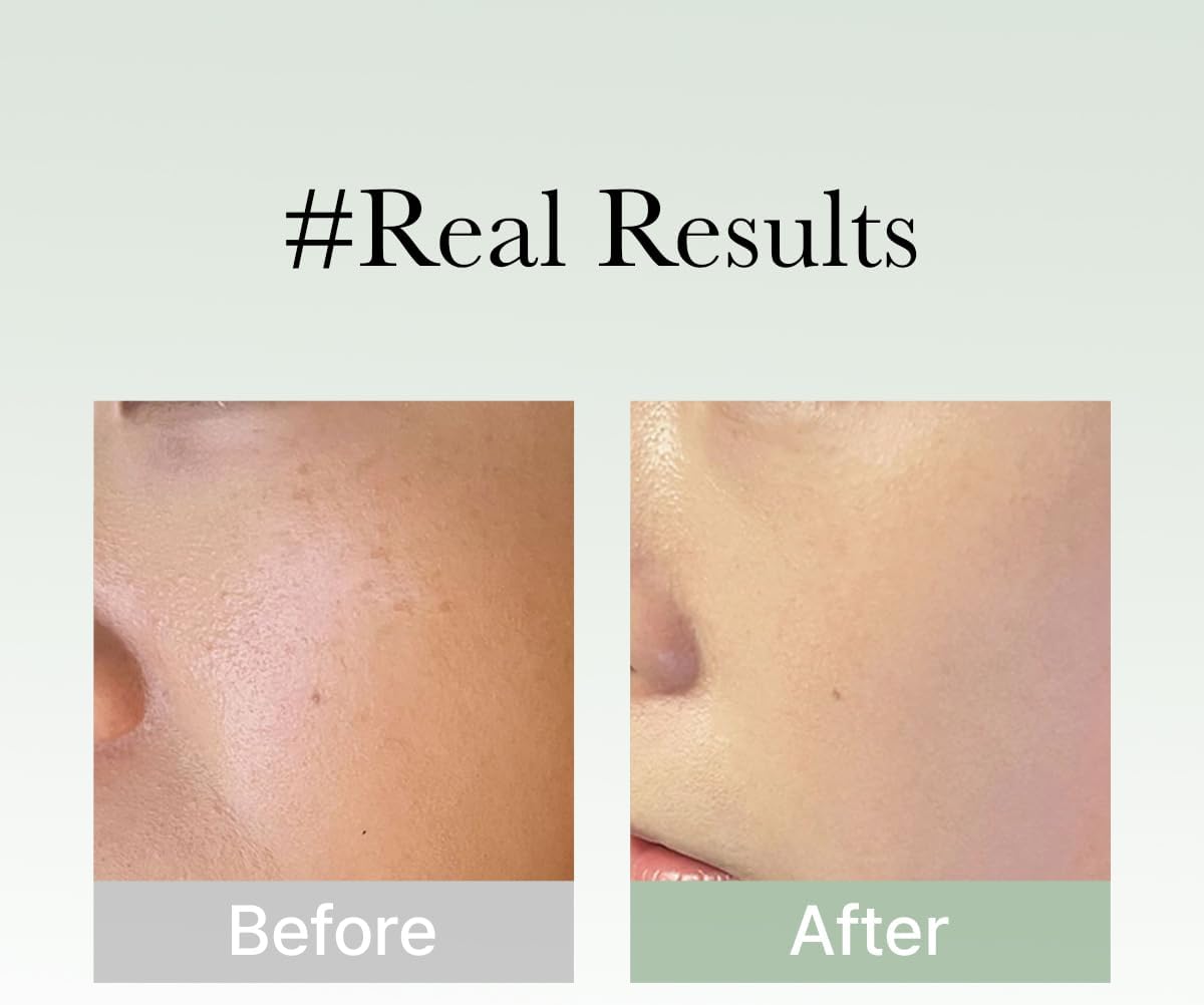 Arencia - Holy Hyssop Serum 12 (30ml)