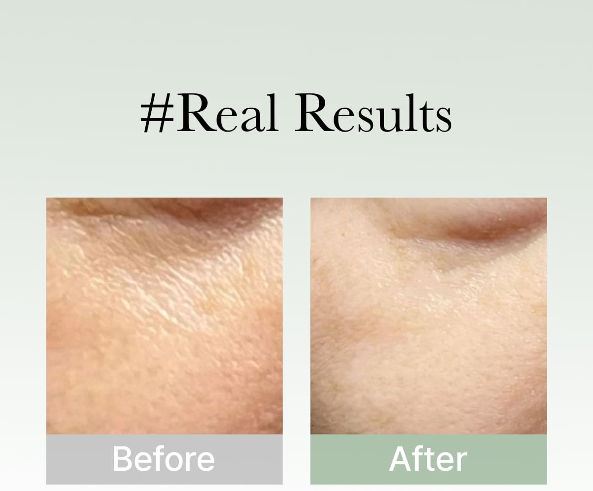 Arencia - Holy Hyssop Serum 12 (30ml)